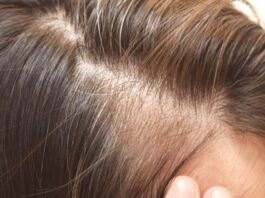 Hair Loss Best Tips: स्ट्रॉन्ग हेयर्स के लिए पिएं ये 5 मेजिकल जूस, बालों का झड़ना हो जाएगा छूमंतर